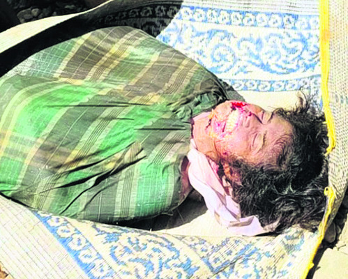 మహిళకు తీవ్రగాయాలు 3