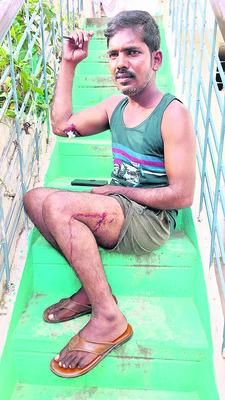 పిచ్చికుక్క స్వైర విహారం4
