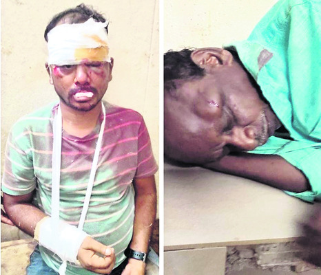 రెండు బైక్లు ఢీ... ఒకరి మృతి
1