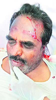 బైక్ ఢీకొట్టడంతో వ్యక్తికి గాయాలు 1