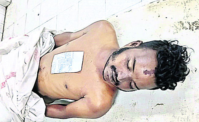 స్కూటర్ ఢీ కొని వ్యక్తి మృతి3