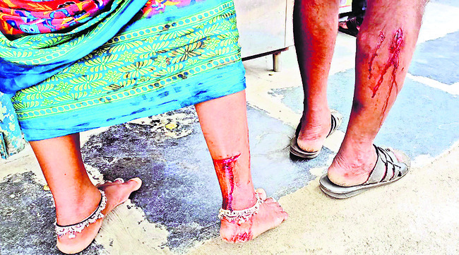 ముగ్గురిపై పెంపుడు కుక్క దాడి1