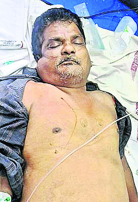 చికెన్3