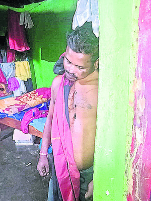 పిడుగుపాటుకు  మూడు పశువులు మృతి 1