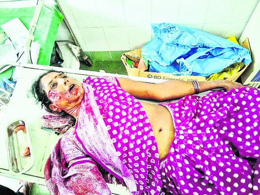 ఆటో బోల్తా పడి ఇద్దరు మహిళలకు గాయాలు1