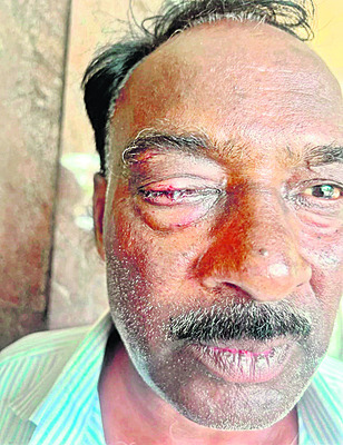 వీఆర్వోపై దాడి
1