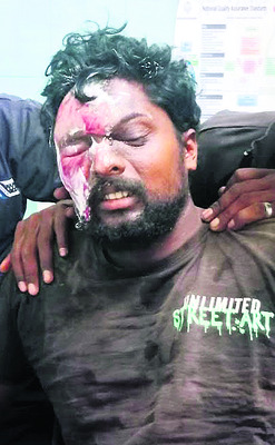 విద్యుత్‌ షార్ట్‌ సర్క్యూట్‌తో ఇల్లు దగ్ధం 2