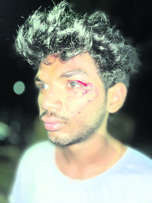 పాఠశాలలో ప్రొజెక్టర్ చోరీ1
