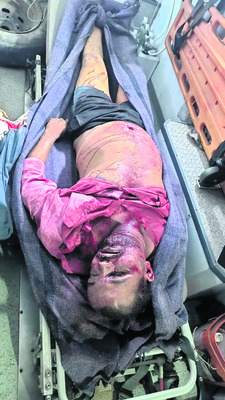 బ్రిడ్జి గుంతలో పడిన కారు
1