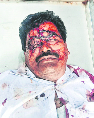 లారీని ఢీ కొట్టిన ఆర్టీసీ బస్సు 1
