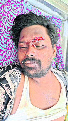 ఆగి ఉన్న లారీని ఢీకొట్టి వ్యక్తి మృతి 1