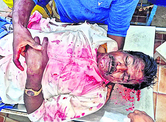 గుర్తు తెలియని వాహనం ఢీకొని మహిళ మృతి2