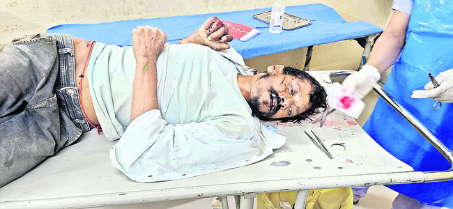 రైలు నుంచి జారిపడి వ్యక్తికి గాయాలు 1