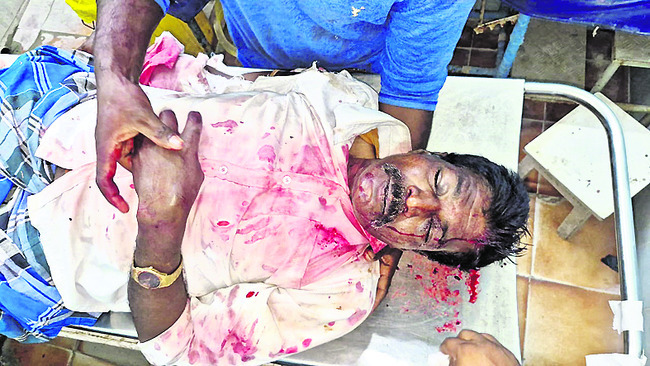 రోడ్డు ప్రమాదంలో గాయపడిన వ్యక్తి మృతి1