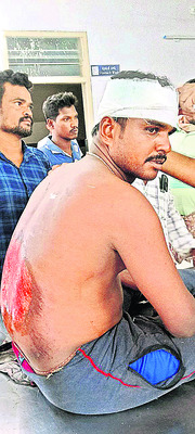 బైక్ను ఢీకొట్టిన కారు 1