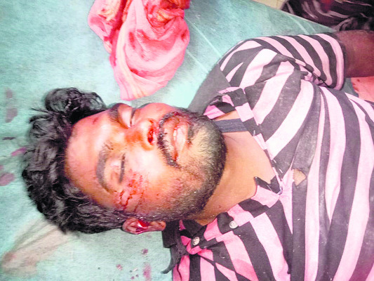 రెండో రోజూ పడిగాపులే!  1