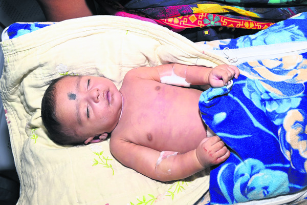 వైద్యం వికటించి బాలుడి మృతి1