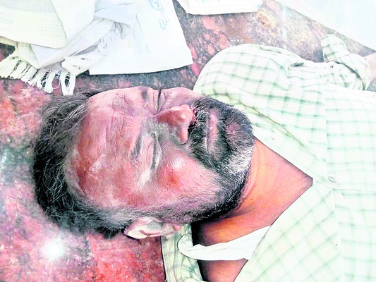 ట్రాక్టర్ బోల్తా పడి ఇద్దరు కూలీల మృతి 2