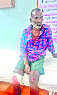 వేర్వేరు రోడ్డు ప్రమాదాల్లో ఐదుగురికి తీవ్ర గాయాలు2