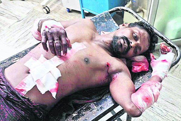 బీరు సీసాతో వ్యక్తిపై దాడి 1