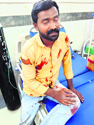 వేర్వేరు రోడ్డు ప్రమాదాల్లో పలువురికి గాయాలు 1