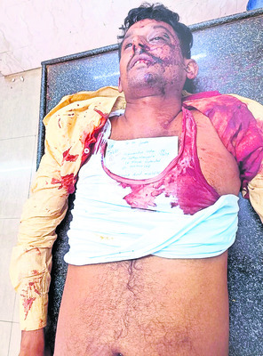 రోడ్డు ప్రమాదంలో తెలంగాణ వాసి మృతి 1