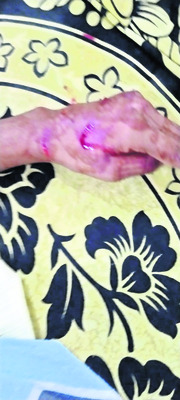 చేపల వేటకు వెళ్లి ఒకరి మృతి3