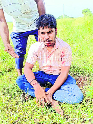 రెండు బైక్‌లు ఢీ.. ఇద్దరికి గాయాలు 2