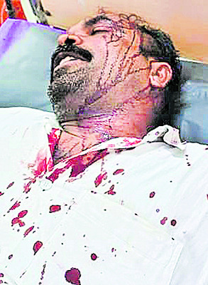 టీడీపీలో ఇరువర్గాల మధ్య ఘర్షణ 1