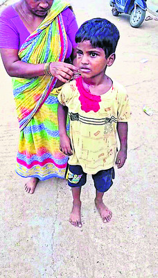 ● జిల్లాలో కుక్కల స్వైర విహారం ● రోజురోజుకూ పెరుగుతున్న1