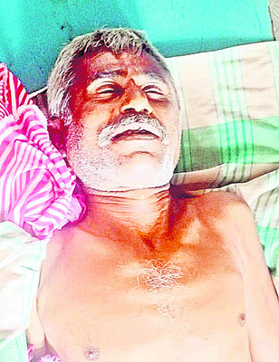 ద్విచక్ర వాహనం ఢీ 
1