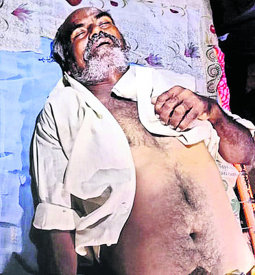 విద్యుత్తు ట్రాన్స్‌ఫార్మర్‌లో మంటలు 1