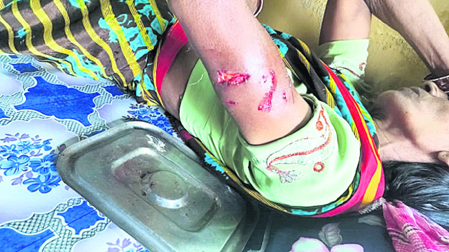చెరువులో పడి బాలుడు మృతి1
