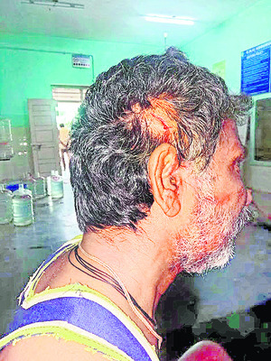 కోతి దాడిలో  12 మందికి గాయాలు 1