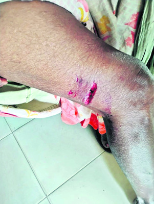 పిచ్చికుక్కల దాడిలో పలువురికి గాయాలు1
