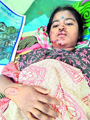 గాయపడిన విద్యార్థిని మృతి 1