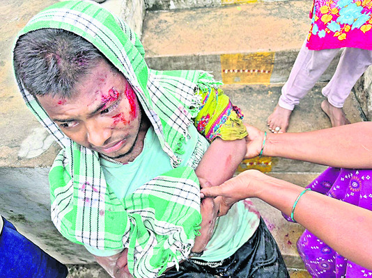 ‘కూటమి’ కక్కుర్తి1