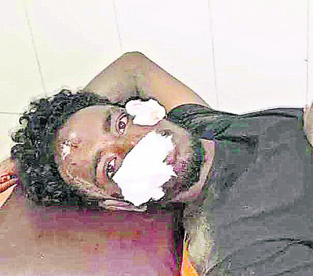 బైక్ అదుపుతప్పి ఇద్దరికి తీవ్ర గాయాలు 1