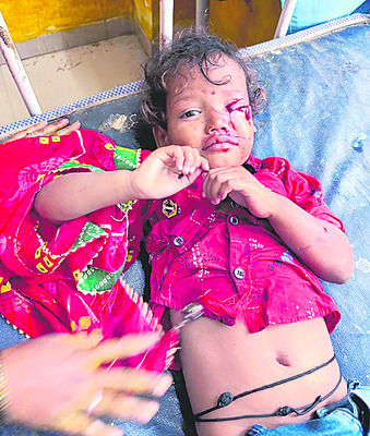 శునకం.. ఇక కంట్రోల్‌ 3