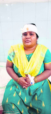 గుర్తు తెలియని వాహనం ఢీకొని గాయాలు 3