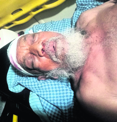 గుర్తు తెలియని వాహనం ఢీకొని గాయాలు 2