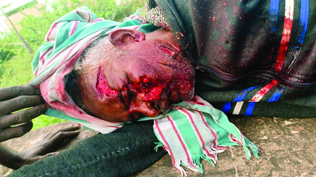 యరగేరాను తాలూకాగా ప్రకటించాలి 2