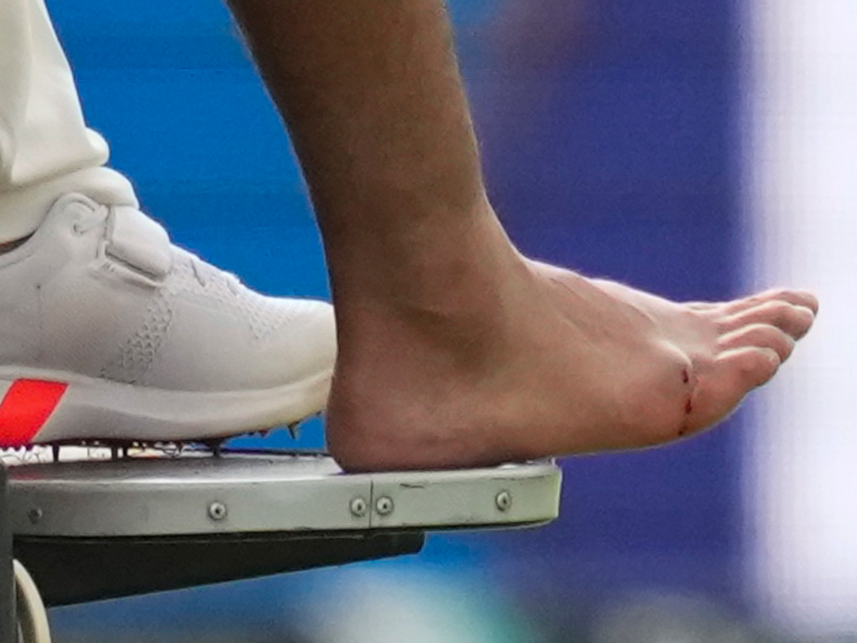 Rishabh Pant injury fourth test India and England Photos9