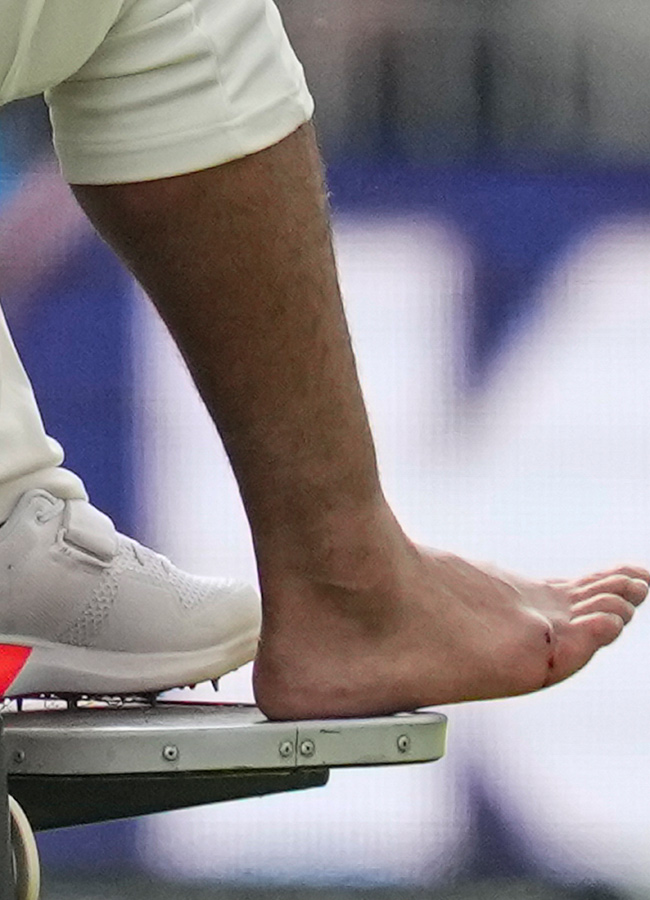 Rishabh Pant injury fourth test India and England Photos16