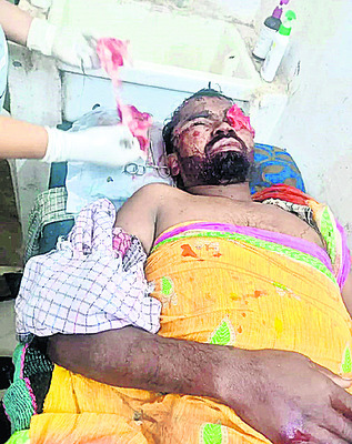 ప్రాథమిక ఆరోగ్యం పరిశీలన 3