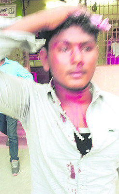 మద్యం మత్తులో యువకుల ఘర్షణ 2