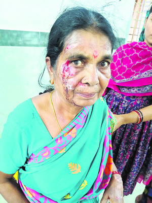 రోడ్డు ప్రమాదంలో  ముగ్గురికి గాయాలు   1