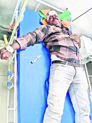 రోడ్డు ప్రమాదంలో  ముగ్గురికి గాయాలు   2