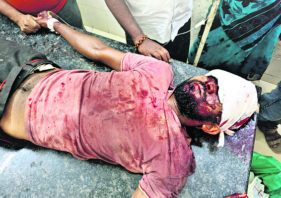 రోడ్డు ప్రమాదంలో వ్యక్తి మృతి 1