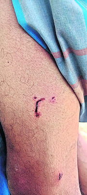 సీతంపేటలో కుక్కల స్వైర విహారం 1